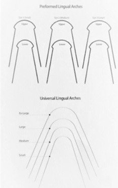 Lingual NiTi Arch Wires