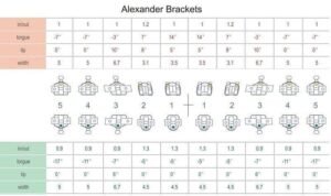 Alexander Brackets