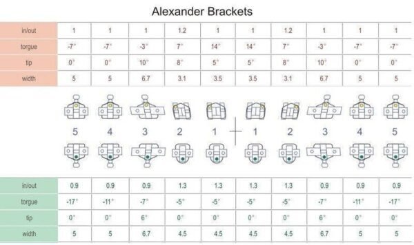 Alexander Brackets