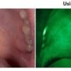 Bio-Screen-1-AdDent.jpg Bio Screen Oral Examination Light - AdDent