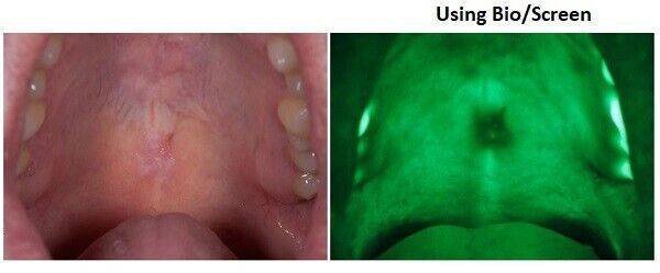 Bio-Screen-1-AdDent.jpg Bio Screen Oral Examination Light - AdDent
