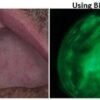 Bio-Screen-2-AdDent.jpg Bio Screen Oral Examination Light - AdDent