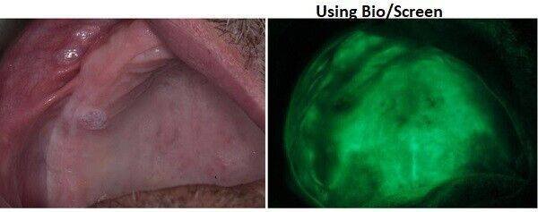 Bio-Screen-2-AdDent.jpg Bio Screen Oral Examination Light - AdDent