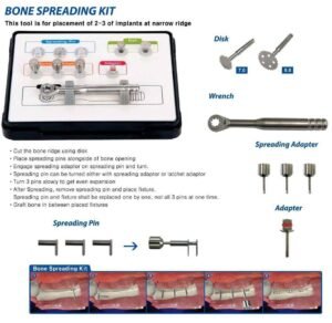 Bone-Spreading-Kit-Surgident.jpg Bone Spreading Kit - Surgident