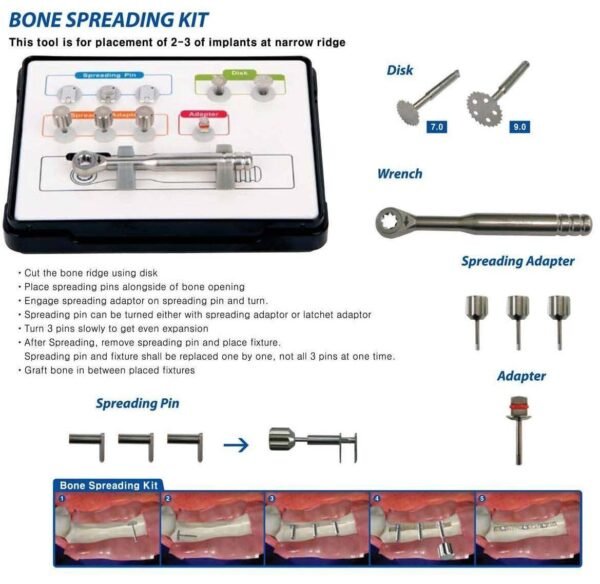 Bone Spreading Kit - Surgident