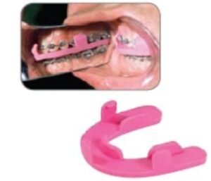Bruxism20Splints2028Dentsply-Glenroe29.jpg Bruxism Splints - Dentsply Sirona