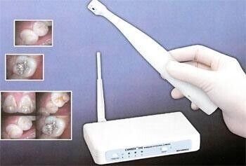 Camrex-192-Wireless-Intraoral-Camera-Dentamerica.jpg Camrex 192 Wireless Intraoral Camera - Dentamerica