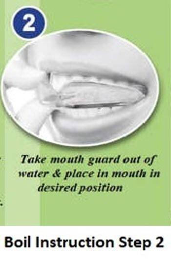Dental Mouth Guard