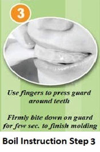Dental Mouth Guard