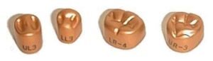 TemGold Permanent Crowns - 2nd Molar