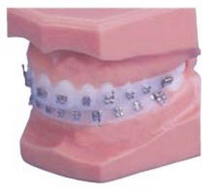 Impression Protector - Dentsply Sirona