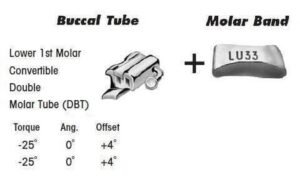 1st Molar Bands Assembly with Lower DBT Buccal Tube