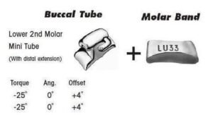 2nd Molar Band Assembly with Lower Single Buccal Tube