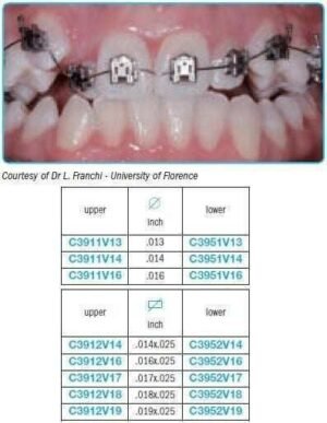 Performed-archwires-V-bend-for-self-ligating-brackets-Leone.jpg Performed archwires V bend for self-ligating brackets - Leone