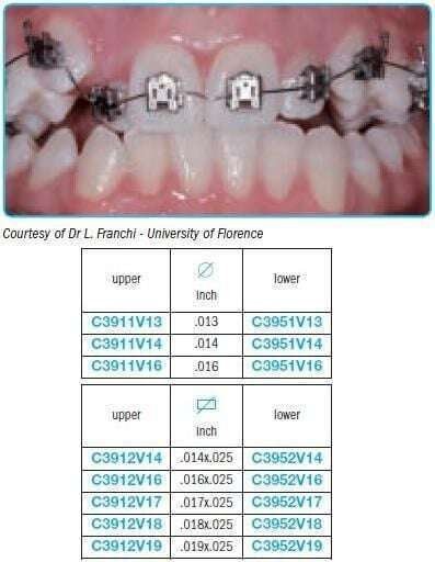 Performed-archwires-V-bend-for-self-ligating-brackets-Leone.jpg Performed archwires V bend for self-ligating brackets - Leone