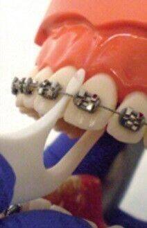 Platypus Orthodontic Flosser