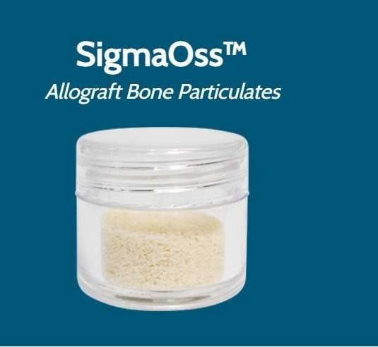 SigmaOss-Allograft-Bone-Particulates.jpg SigmaOss Allograft Bone Particulates