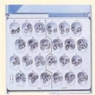Stainless-Steel-Second-Primary-Crown-DA.jpg Stainless Steel Second Primary Molar Crowns Replacement - DA