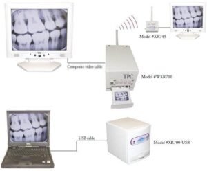 X-ray Film Reader- TPC
