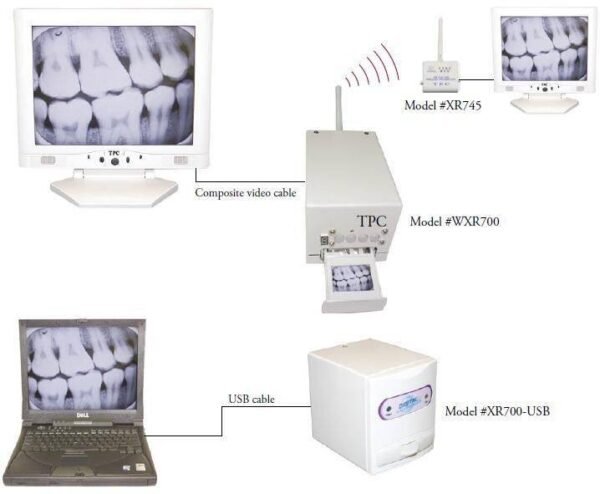 X-ray Film Reader- TPC