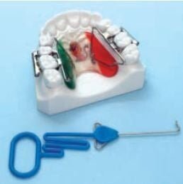 Rapid Molar Distalizer First Class - Leone