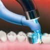Trimax Composite Instrument - AdDent